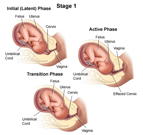 Stage 1 of labor